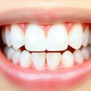 루나덴탈 치과기공소 | 잇몸에 좋은 치약 추천 제품 TOP5 잇몸케어 치약