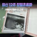 새봄여성병원 | 임신 12주 분만병원 결정! 인천 부평 새봄여성병원 첫 진료 후기 (NT검사, 초음파 기록)