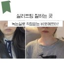 실리프팅 잘하는 곳 내돈내산 리얼 비포애프터후기에요