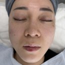 보니따피부관리 | 보니따 마곡점 물광피부관리 후기