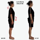 다모아결혼정보 | 부평 체형교정 다모아체형교정센터 DL 듀엣레슨과 BR...차이점 및 추천 대상, BR 바디리모델링 솔직후기