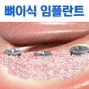 바로심는치과의원 이미지