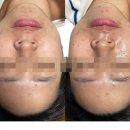 세종피부관리 탄력없이 처진 얼굴 더파민으로 해결🤸‍♀️한 [정담아 에스테틱] 후기~😘