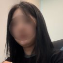 포도송이 이중턱 7일차 내돈내산 후기