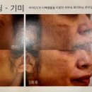 하단빛나스킨룸 네이버블로그