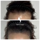 새로이숲부평 | 인천두피문신은왜?새로이숲_부평인가?