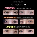 드레스성형외과 네이버블로그