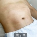 뷰티soo