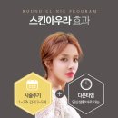 아우라의원. 네이버블로그