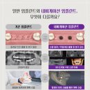 강구치과의원 | 울산치과의원 자유로운 식생활 되찾도록