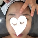 델루나뷰티 | 풍무동피부관리 델루나뷰티 물방울관리 + 좁쌀여드름 압출 후기!