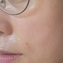 주식회사 유바이오메드 | 병풀추출물 플라센타 허발 컨덕터블 볼륨 겔 H 거칠었던 내피부 촉촉해짐