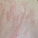 웰빙플러스의원 | 부산 온천동 웰빙플러스의원 두드러기 치료 후기 — 주말·공휴일까지 진료하는 믿음의 병원 얼마 전...