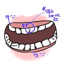 유리드믹스 6-11개월 B | 치아교정 일기 04) 11개월차 후기- 불광역 치과, 발치공간 닫힘, 성인 돌출입 치아교정, 치간삭제 후기