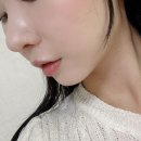 뉴비아 턱필러 후기 무턱 탈출하고 얼굴형 확 바뀐 리얼 후기