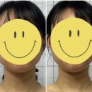 신기 | 부산서면두골비 로온 얼굴안면비대칭 운동 신기했던 후기