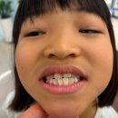 김지용치과의원 | 대구 교정 전문 치과 김지용 교정치과에서 부정교합 교정