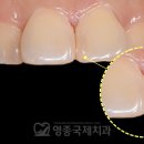 인천중구양심치과 찾고 계신 분들께 도움이 되는 글