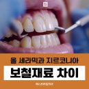 광장치과재료 이미지