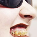 V라인S라인 이미지