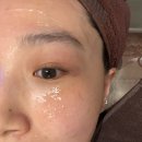 김포제일한의원 | 김포 구래동 신상 피부과 추천 | 온다 리프팅 맛집 | 화사한의원