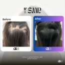 바디닥터삼송역점 | 민생회복 소비쿠폰 경기지역화폐 비가맹점 사용가능!