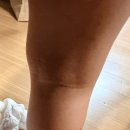 도도약국 | 가려움 완화 로션 찾다 만난 도도더마올인원로션, 아토피 가족의 선택