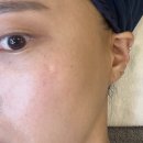 라비에 에스테틱 | 안산 피부케어맛집 라비에에스테틱 물방울리프팅(LDM) 후기