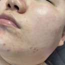미가랑스킨케어 네이버블로그