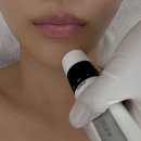 비전메디칼 | 피부 진단 및 퍼스널 스킨케어 MTS 물광 스킨 부스터 후기, 뽀에따