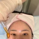 고운한의원 | 서면 한의원 라보센(=엑소좀) 스킨부스터 MTS 후기!