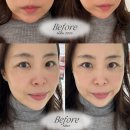 더빅스 | 의정부 피부관리 스킨뮤즈 셀빅스 관리받고 물광피부 후기