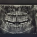 두류사랑니치과의원 이미지