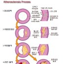 수축기 혈압 200 이상이라 혈압약 (이달비정40mg) 먹는 분의 질문에 대한 답변 이미지