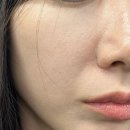 신매사우나 | 경산피부과 추천 대구 줄기세포주사 후기 리쥬엘