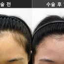 연세모나의원 네이버블로그