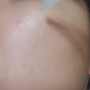 <b>에스알</b><b>픽</b> 트러블 자국 모공수축 티트리폭탄 에센스 피부진정을 위해 사용하고 있어요~