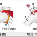 평거연합의원 네이버블로그