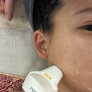 마인 | 양산피부관리 추천 뷰티마인 하이푸리프팅 데콜테관리 후기