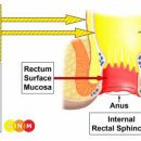 장 및 직장 - 시그마결장과 직장 근육(상부 직장) 이미지