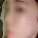 부천메디컬타워 | 부천 상동 피부관리 온에스테틱 물광피부 관리 후기