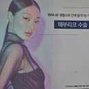 뉴원성형외과의원 이미지