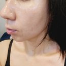 김해피부관리 건조한피부에 딱인 빈스뷰티 내돈내산 솔직후기