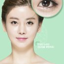 안양눈성형 팩트