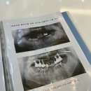 행복을 주는 치과 | 옥길동치과 | 더행복한치과 | 스케일링 추천