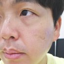 미소피부 운정역점