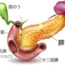 「만성췌장염」으로 진단되는 사람이 증가하고 있는 것은 왜？ 이미지