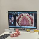 연세바로치과교정과치과의원 | 연세바로치과교정과치과의원 부천점 방문 후기