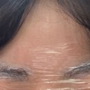 동탄 눈썹문신 제거후기 여자눈썹문신 1~6차제거 망한눈썹 고치기 동탄제이에스뷰티