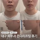 세븐일레븐 대구큰고개점 | 대구 동성로 피부과 온다리프팅,턱선 이중턱 솔직후기